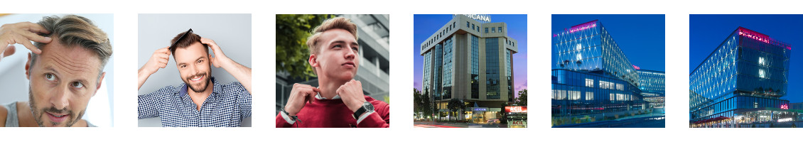 Poraďte se s námi o transplantaci vlasů v Turecku
