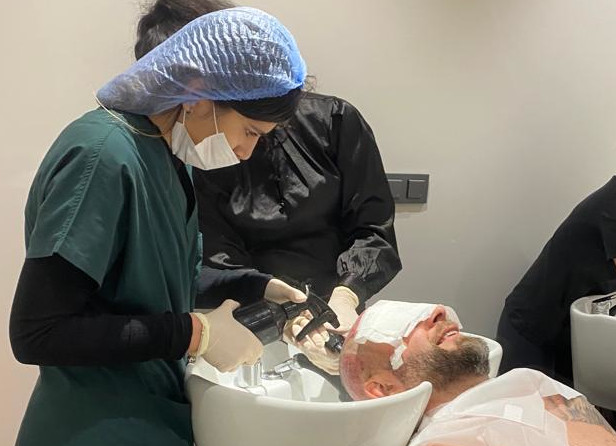 Cesta za novými vlasy krok za krokem. Reálný příklad. 10 První mytí hlavy po transplantaci vlasů v Istanbulu
