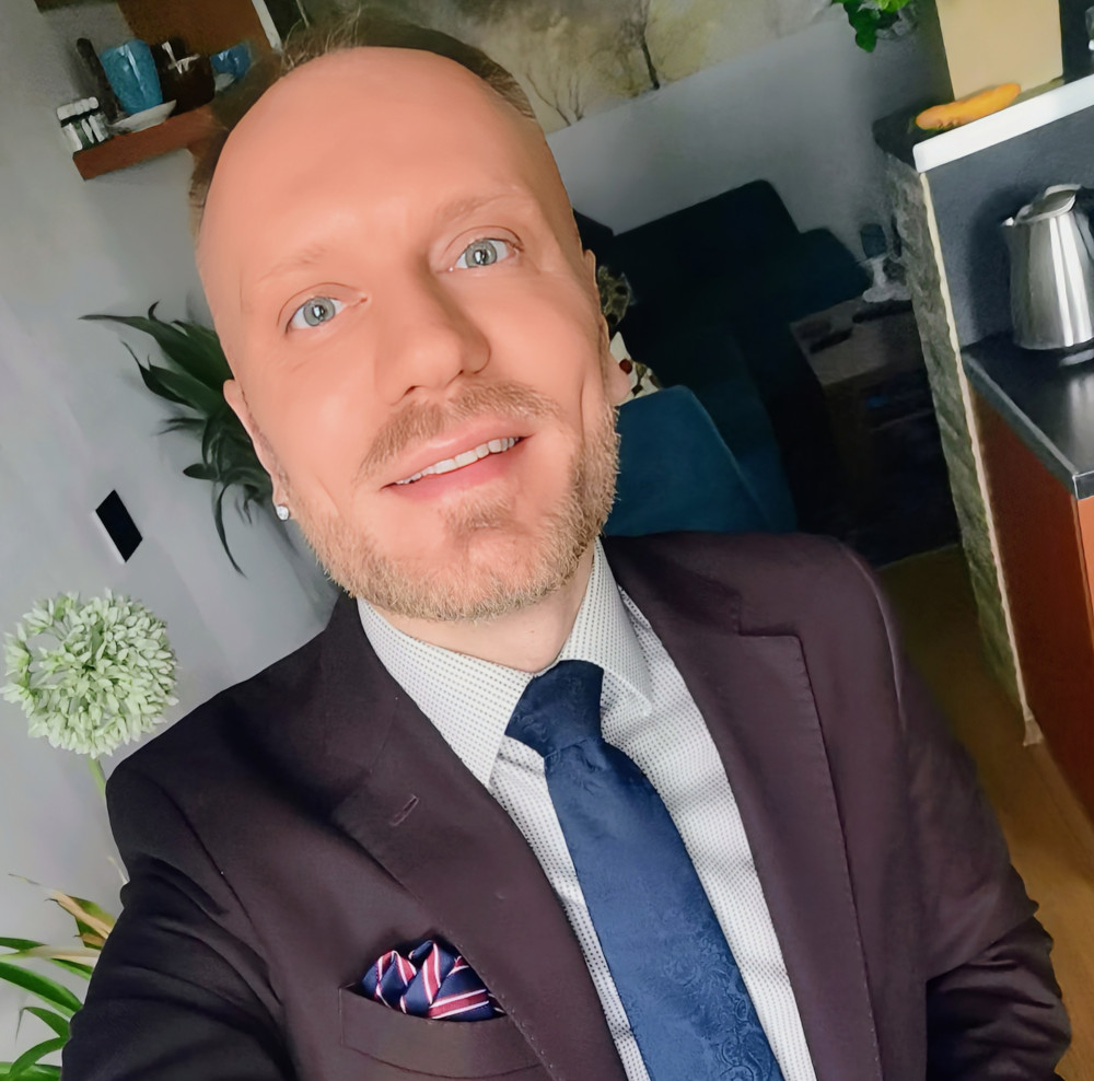 Rok po zákroku: Od pochybností k novým vlasům - příběh pana Jiřího 1 Foto před transplantací vlasů